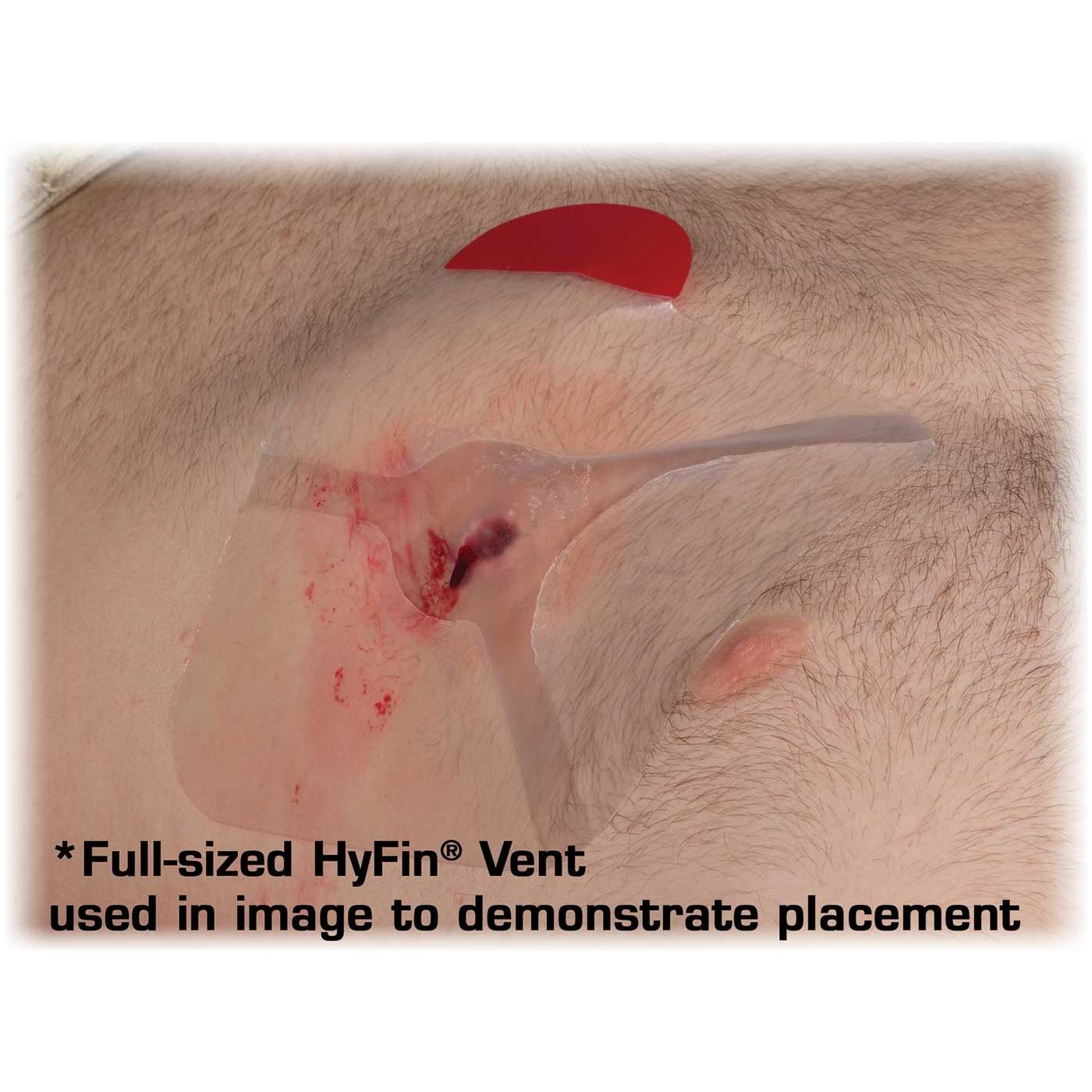 Hyfin Vent Compact Chest Seal Twin Pack